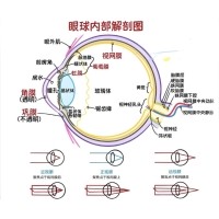 視網(wǎng)膜眼科中不同波長濾光片的應用
